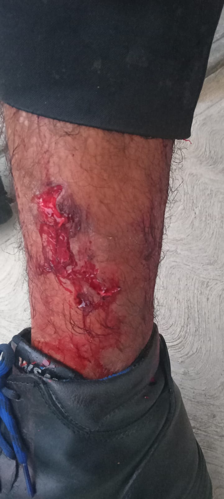 ataque de perro