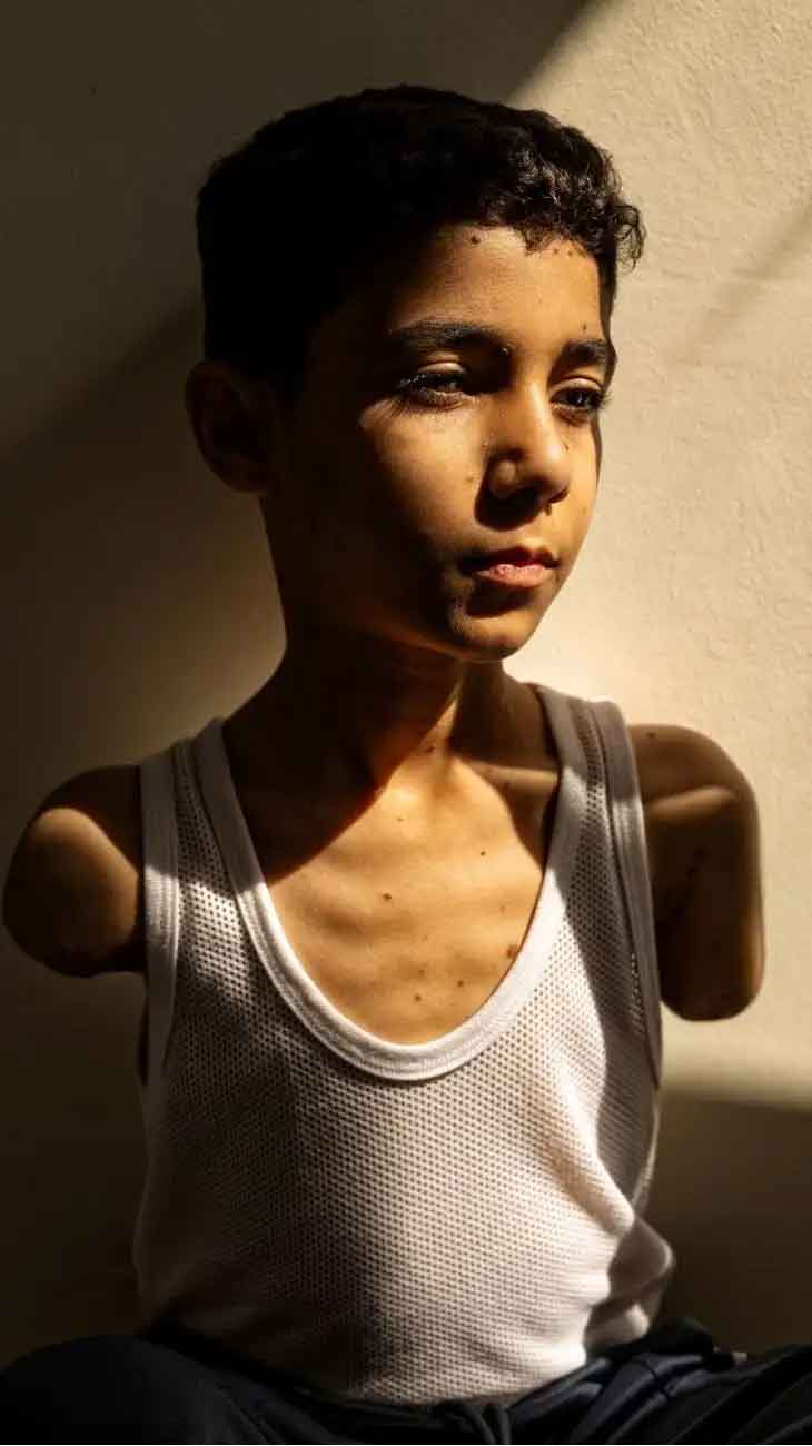 Imagen de niño herido en Gaza gana Foto del Año