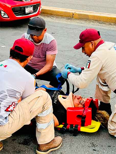 Mujer cae a bache con su moto y se fractura la mano en Izúcar