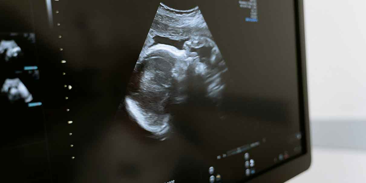 Maternidad