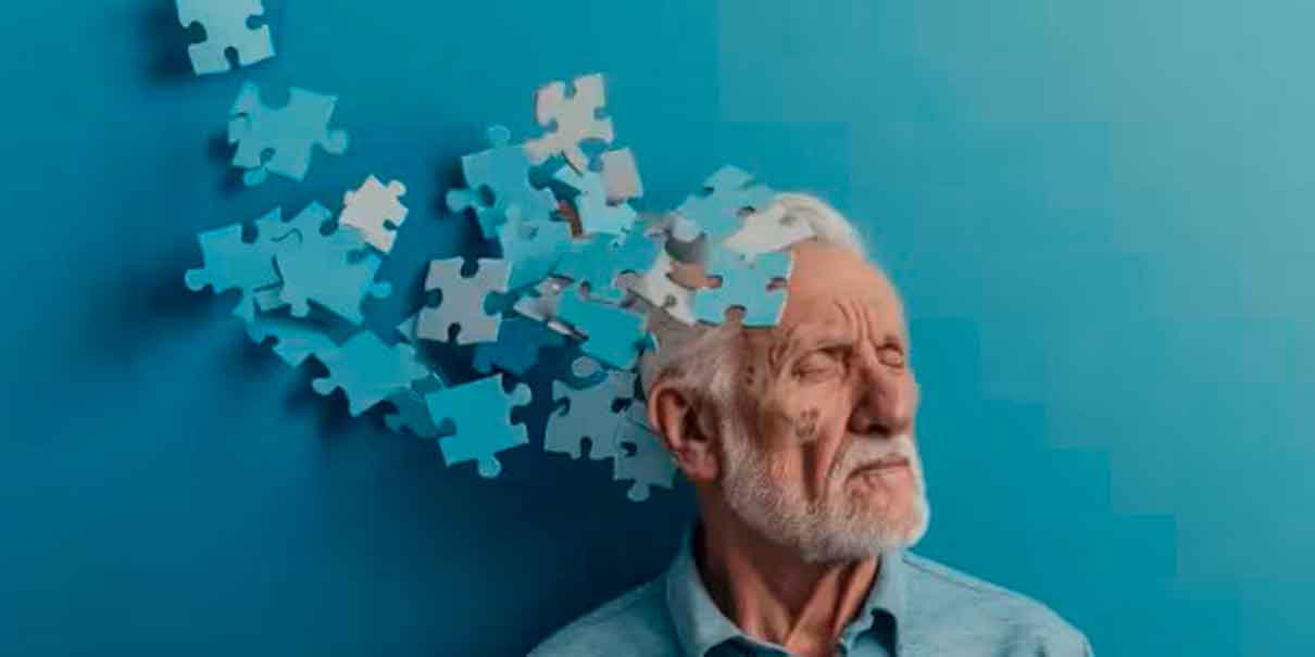 Alzheimer