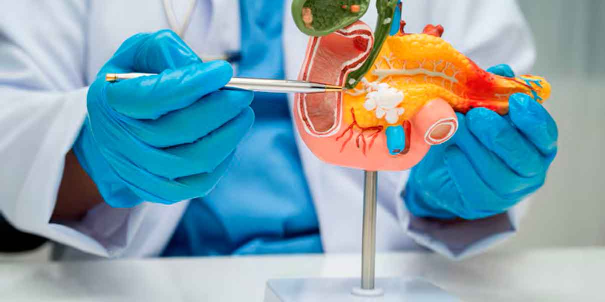 Cáncer de páncreas