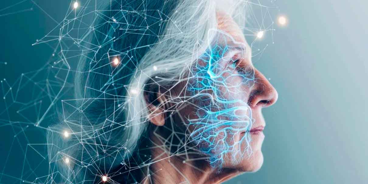 Alzheimer