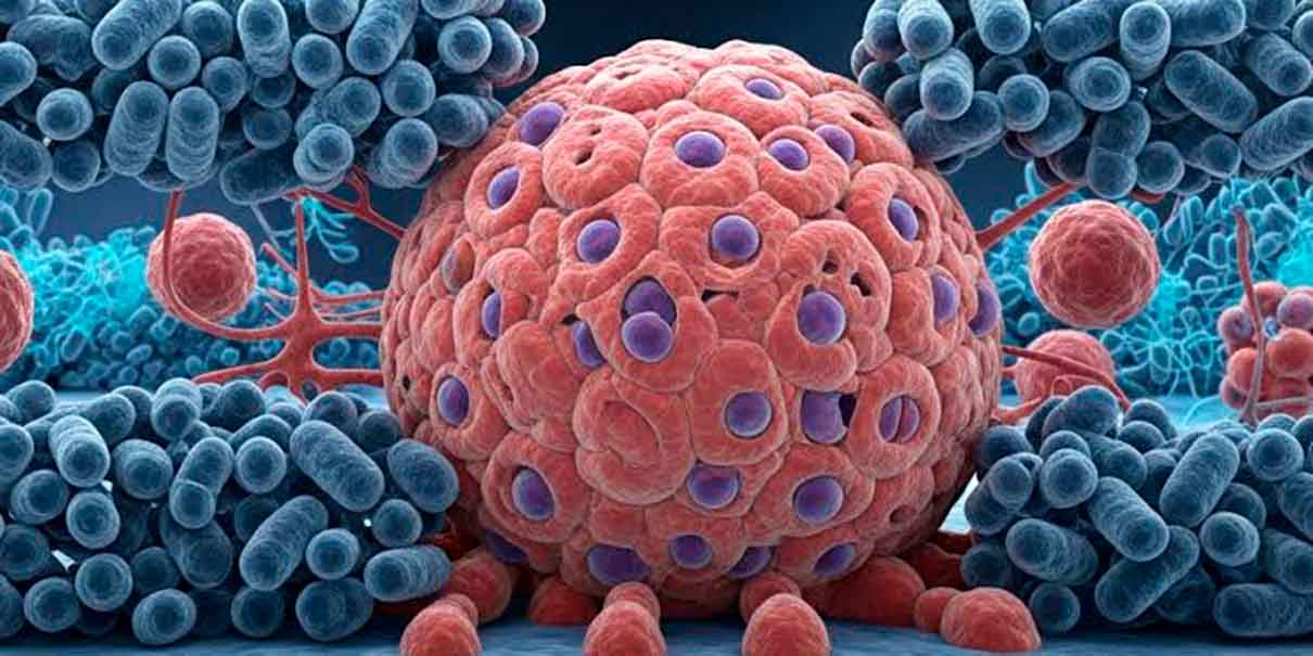 Cáncer