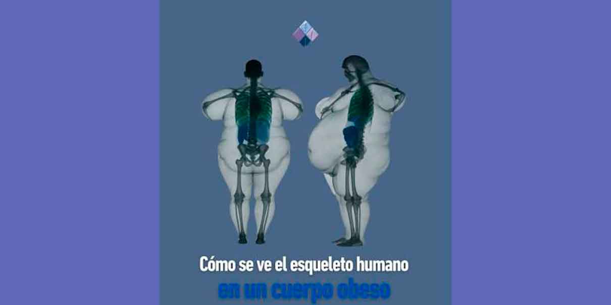 Huesos
