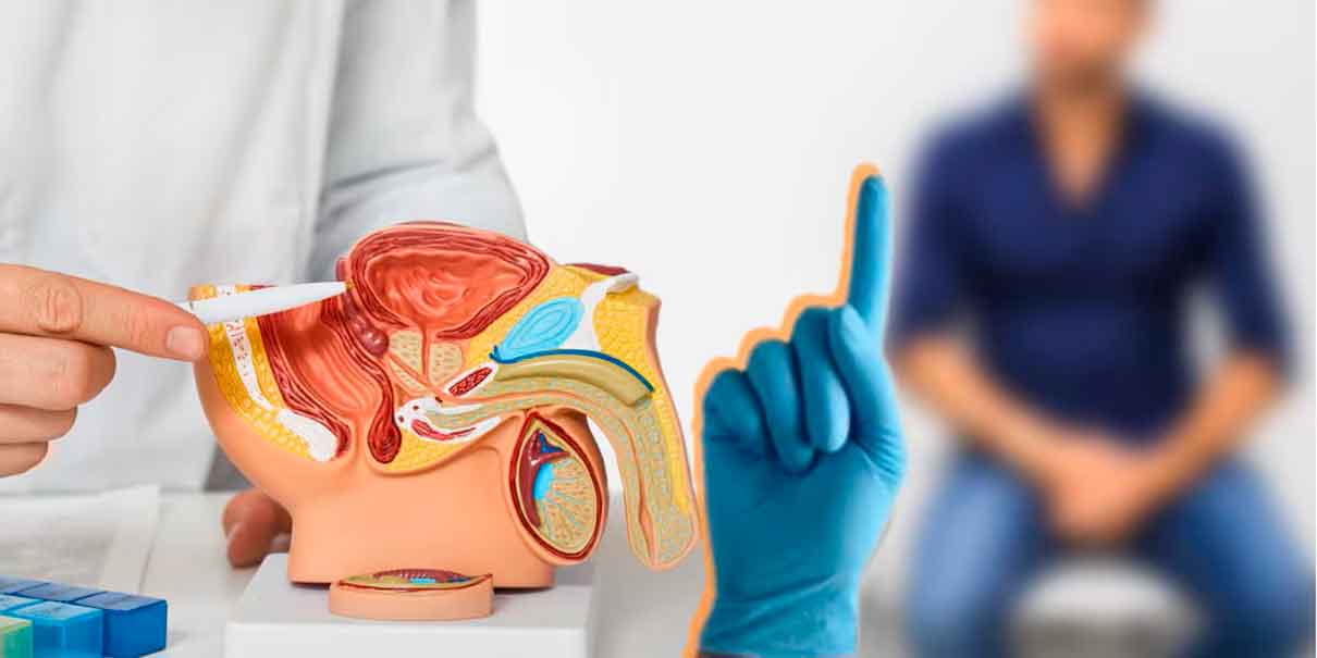 Cáncer de próstata