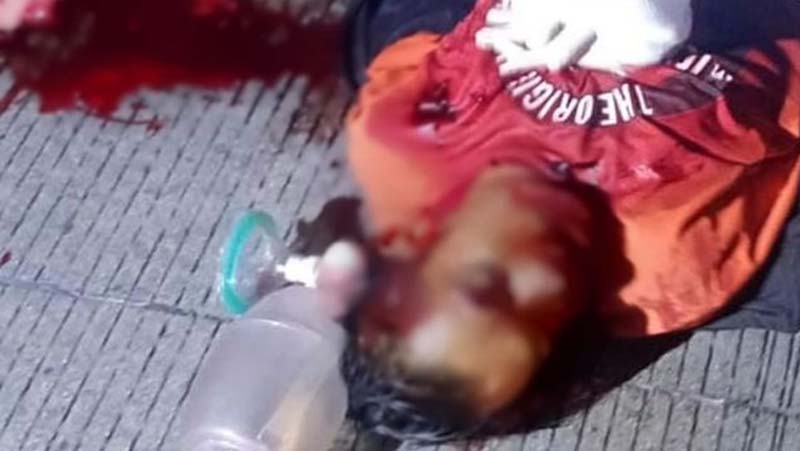 Muere joven tras brutal agresi贸n en el bulevar Los Volcanes de Atlixco