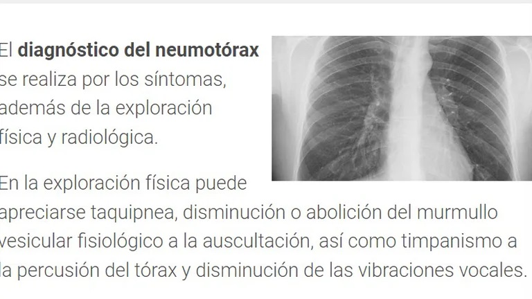 pulmón