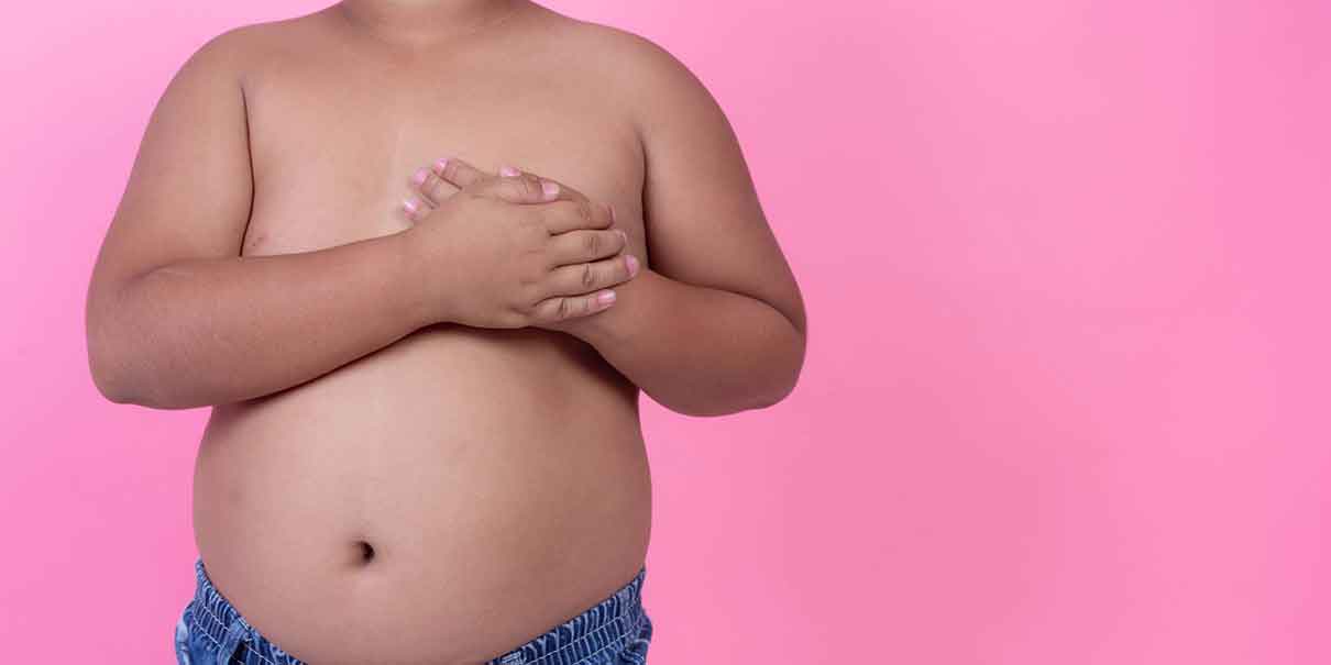 Obesidad infantil