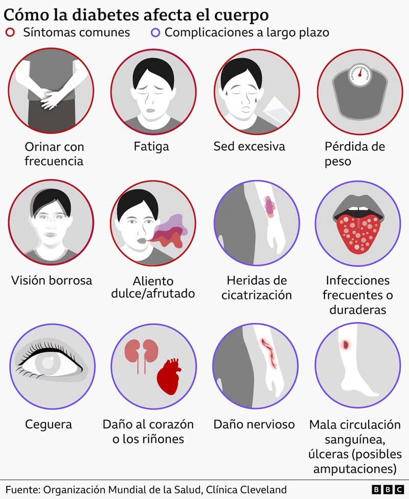 ¿Qué es la diabetes tipo 5? La nueva categoría que puede ser mortal si se trata mal