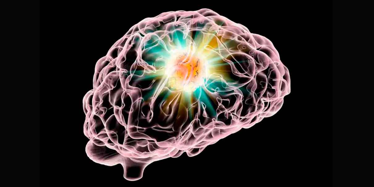 Cerebro