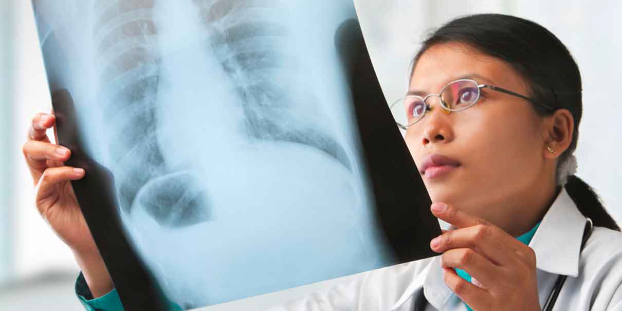 tuberculosis respiratoria