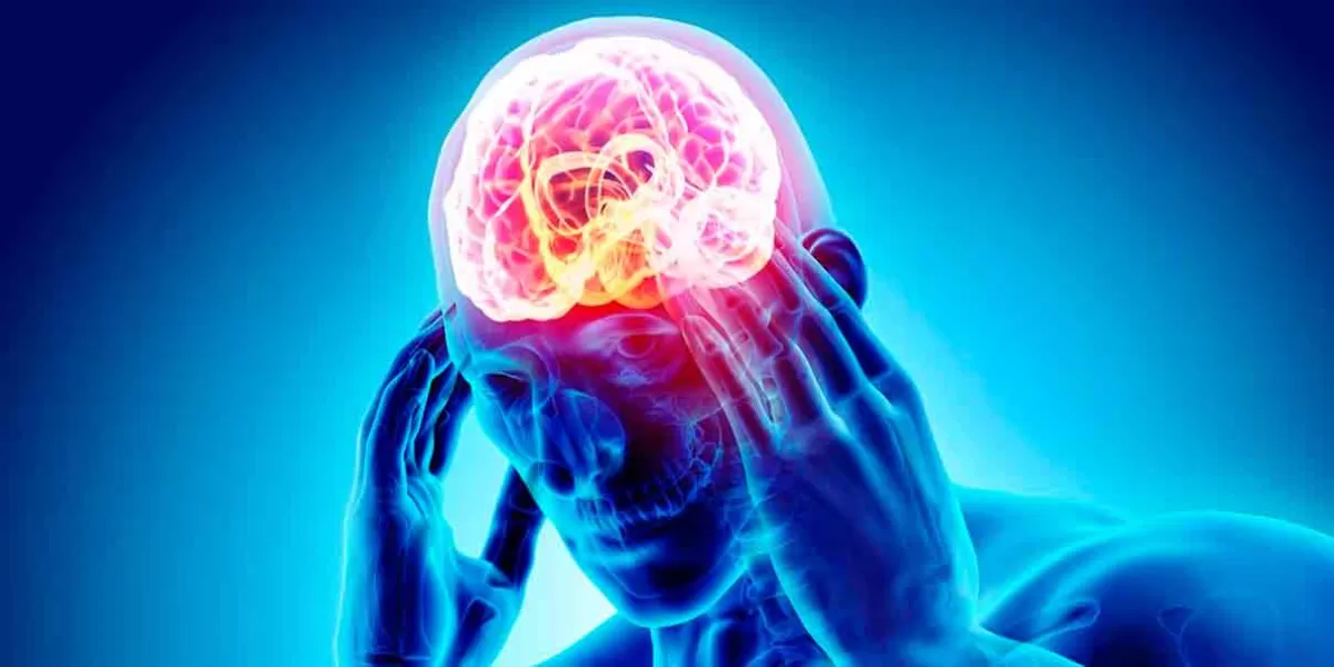 ESTRATEGIA “CAMALEÓN”. Infarto Cerebral, puedes prevenirlo para evitar secuelas y la muerte