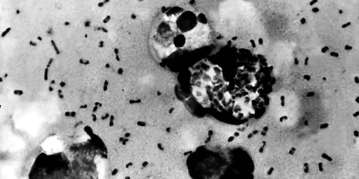 Regresa la Peste Bubónica en 2024; se registra la primer muerte por esta bacteria 