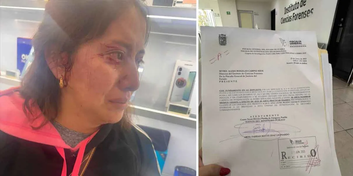 Atacan a madre e hijo con autismo en el Mercado Benito Juárez de Atlixco