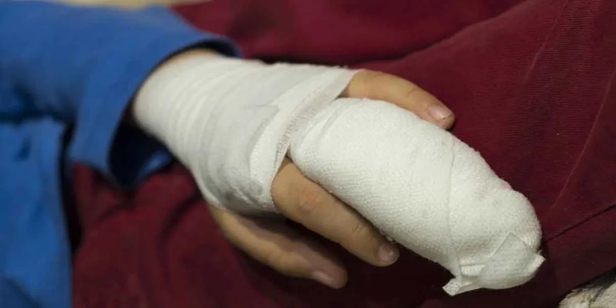 Aumentan riesgos de fracturas y quemaduras en niños durante vacaciones