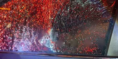 Atacan a balazos a alcaldesa de Ayotoxco en autopista Amozoc–Perote