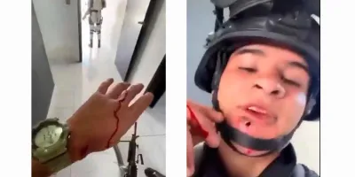 VIDEO. Soldado relata enfrentamiento con el “El Mencho” con bala incrustada en su rostro 
