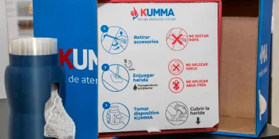 Talentos IBERO Puebla desarrollan un sistema integral para la atención de quemaduras de segundo grado
