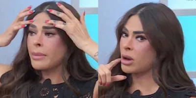 Galilea Montijo cuenta el doloroso proceso que enfrentó tras una cirugía estética