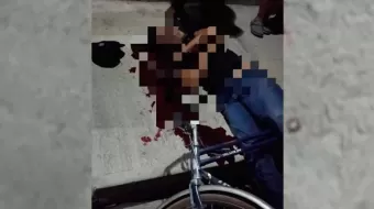 Impactó bala perdida en la cabeza de un ciclista en Xalmimilulco