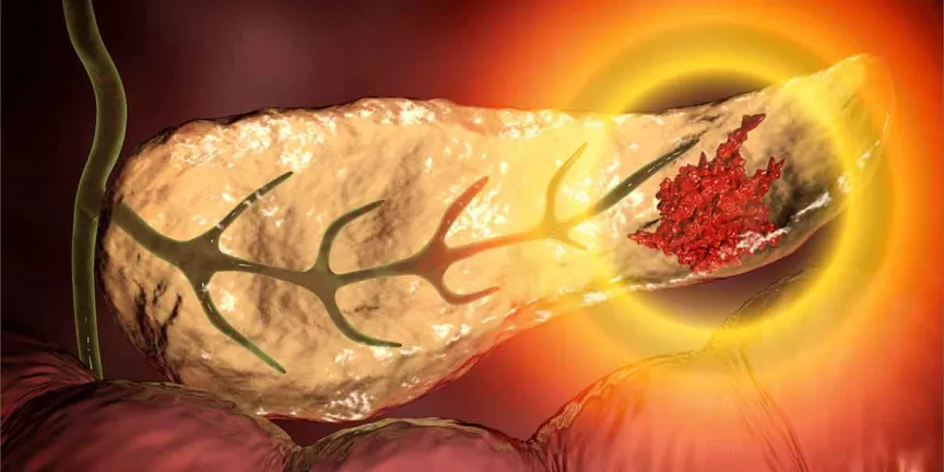 Terapia experimental logra curar el CÁNCER de páncreas más agresivo en RATONES