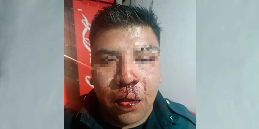 Choque terminó en golpiza a policía municipal de Texmelucan 