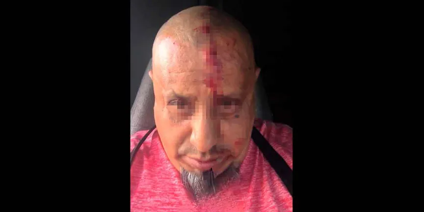 Intento de robo en la Puebla-Orizaba deja a transportista herido de bala